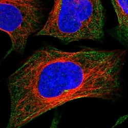 CCDC167 Antibody, Novus Biologicals 0.1mL; Unlabeled:Antibodies, Polyclonal